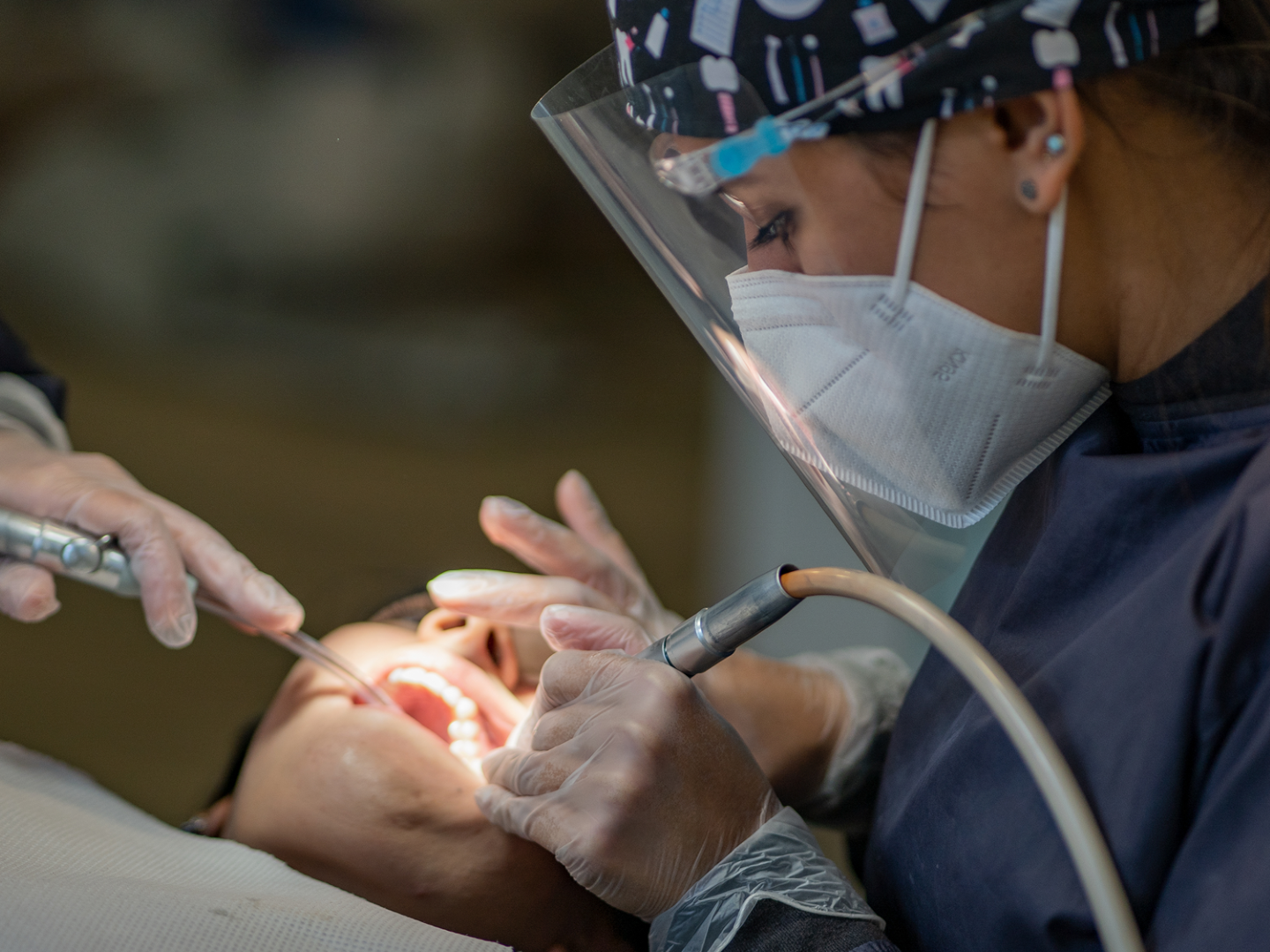 2. Coronas de Zirconio 2 (Large) Mitos y Verdades Sobre la Frenectomía Láser: Aclara tus Dudas