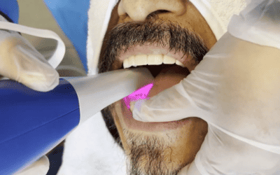 ¿Qué es un escáner intraoral?