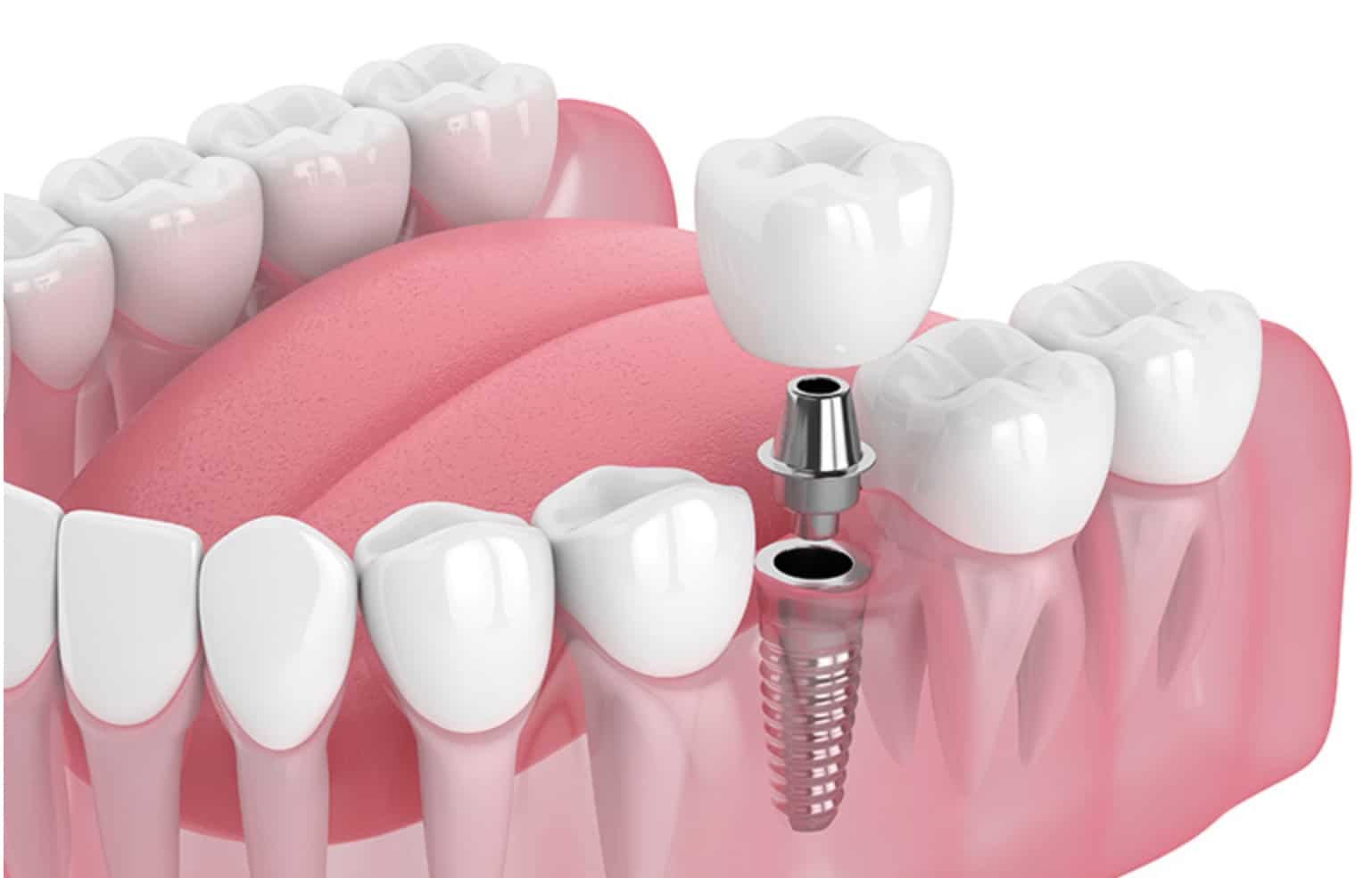 Imagen-8-01-24-a-las-10.55