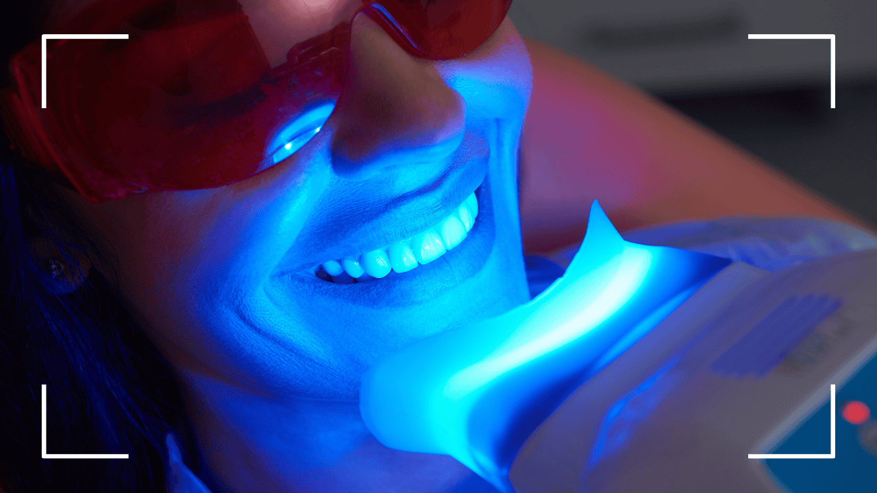 Blanqueamiento dental Descubre las opciones para una sonrisa radiante Blanqueamiento dental: Descubre las opciones para una sonrisa radiante