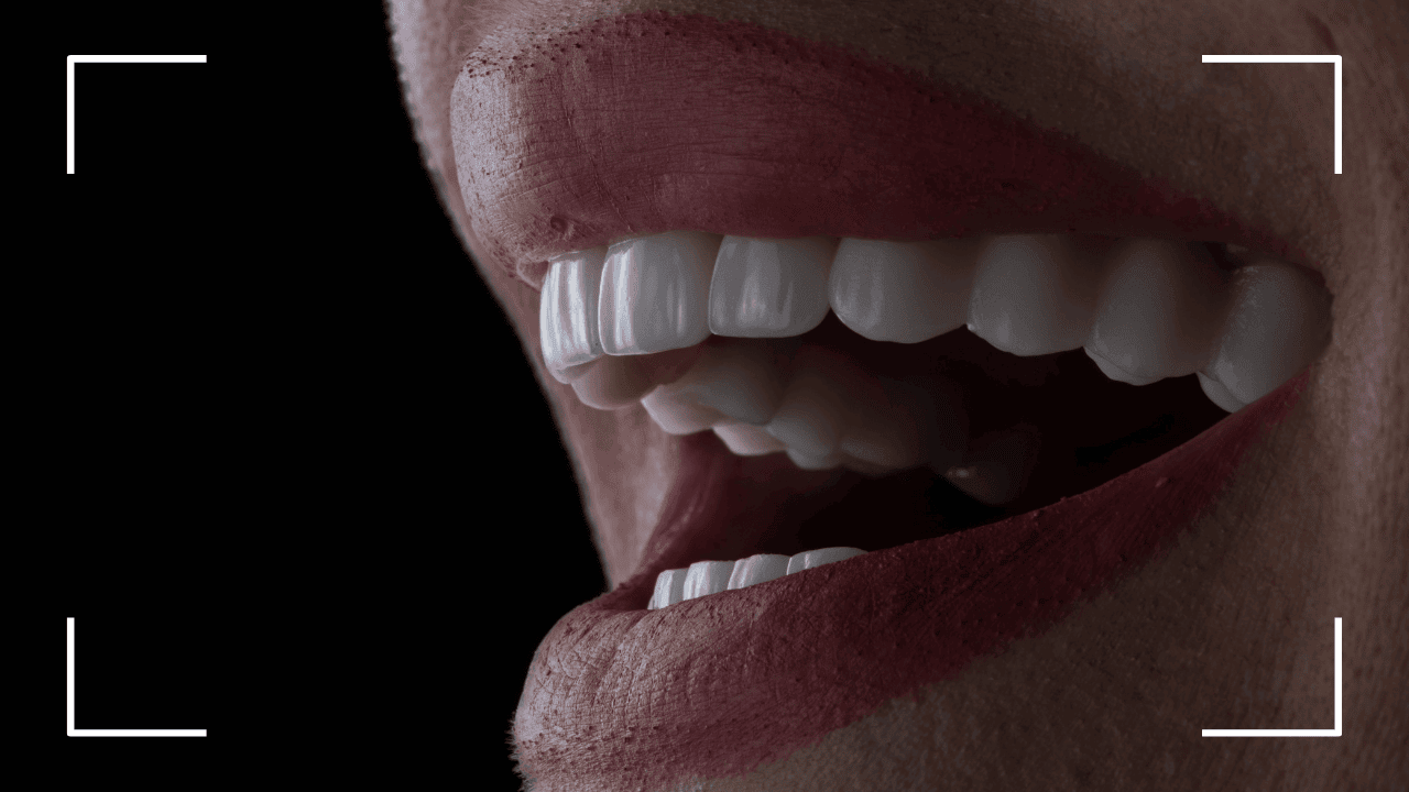 Tiempo de reposo tras un implante dental ¿Cuánto tiempo debo esperar (1) Tiempo de reposo tras un implante dental: ¿Cuánto tiempo debo esperar?